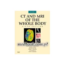 CT and MRI of the Whole...