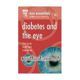 Eye Essentials:  Diabetes...