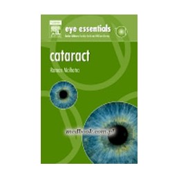 Eye Essentials: Cataract