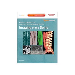 Imaging of the Spine
