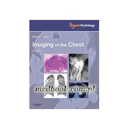Imaging of the Chest,...