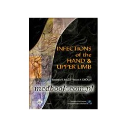 Infections of the Hand and Upper Limb