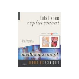 Operative Techniques: Total Knee Replacement