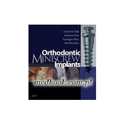 Orthodontic Miniscrew Implants