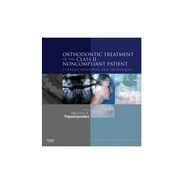 Orthodontic Treatment of the Class II Noncompliant Patient