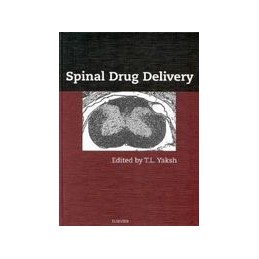 Spinal Drug Delivery