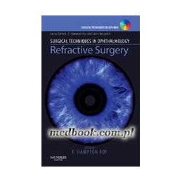 Surgical Techniques in Ophthalmology Series: Refractive Surgery