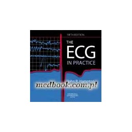 The ECG In Practice