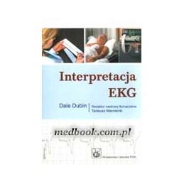 Interpretacja EKG