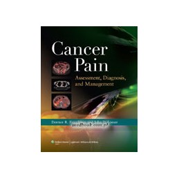 Cancer Pain: Assessment,...