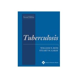 Tuberculosis