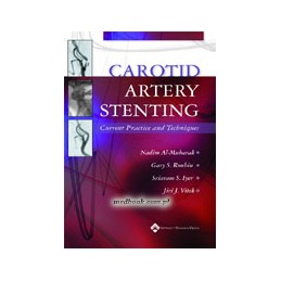 Carotid Artery Stenting