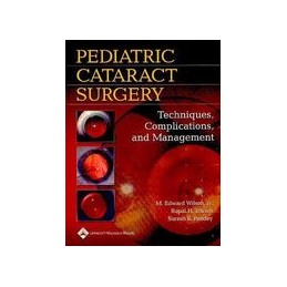 Pediatric Cataract Surgery