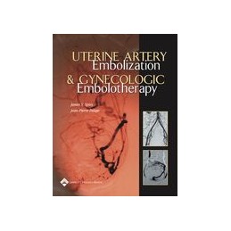 Uterine Artery Embolization...