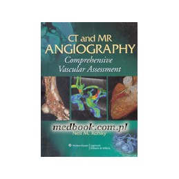 CT and MR Angiography