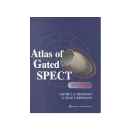 Atlas of Gated SPECT CD-ROM