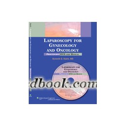 Laparoscopy for Gynecology...