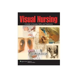 Visual Nursing