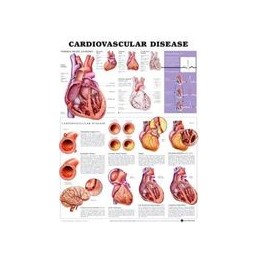Cardiovascular Disease...