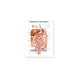 Diseases of the Digestive System Anatomical Chart in Spanish (Enfermedades del Sistema Digestivo)