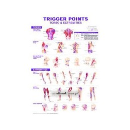 Trigger Points Giant Chart