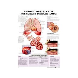 Chronic Obstructive...