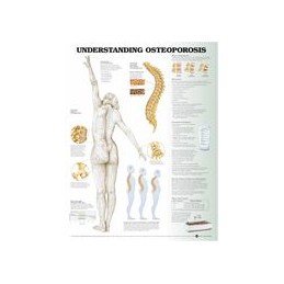 Understanding Osteoporosis...