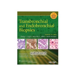 Transbronchial and...
