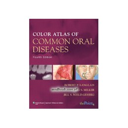 Color Atlas of Common Oral Diseases