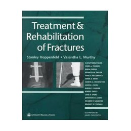 Treatment and Rehabilitation of Fractures