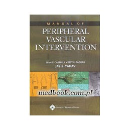 Manual of Peripheral Vascular Intervention
