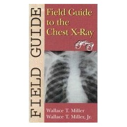 Field Guide to the Chest X-Ray