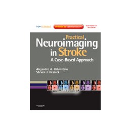 Practical Neuroimaging in Stroke