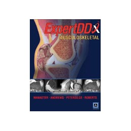 EXPERTddx: Musculoskeletal