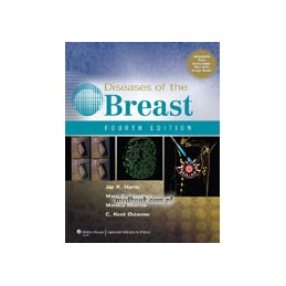 Diseases of the Breast