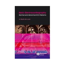 Basic Electrocardiography:...