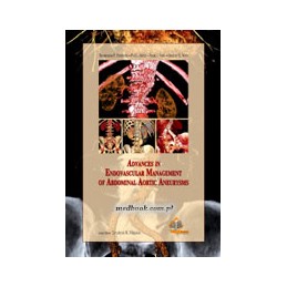 Advances in Endovascular Management of Abdominal Aortic Aneurysms