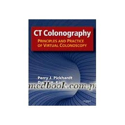 CT Colonography: Principles and Practice of Virtual Colonoscopy