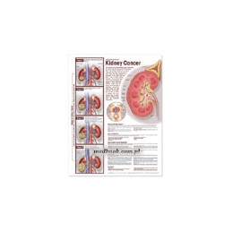 Understanding Kidney Cancer Anatomical Chart