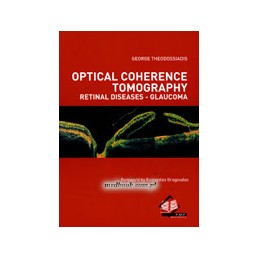 Optical Coherence Tomography Retinal Diseases - Glaucoma