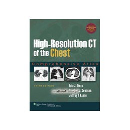 High-Resolution CT of the...