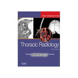 Thoracic Radiology: The...