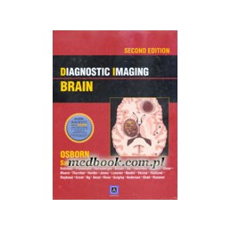 Diagnostic Imaging: Brain
