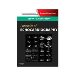 Principles of Echocardiography and Intracardiac Echocardiography