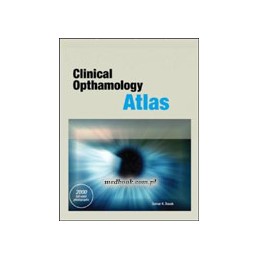 Clinical Ophthalmology  Atlas