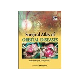 Surgical Atlas of Orbital Diseases