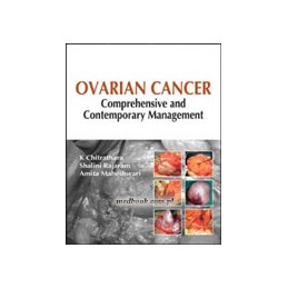 Ovarian Cancer:...