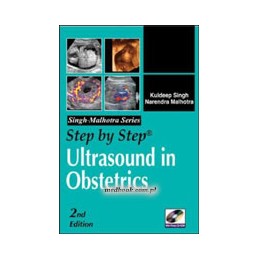 Step by Step Ultrasound in Obstetrics, Second Edition