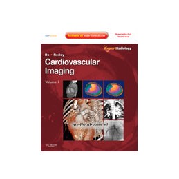 Cardiovascular Imaging,...