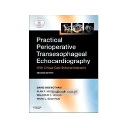 Practical Perioperative Transesophageal Echocardiography